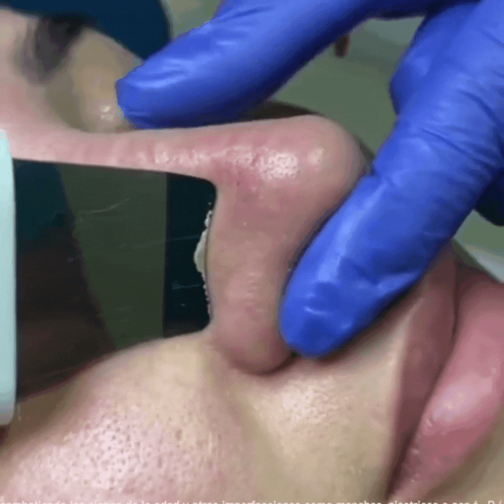 LIMPIADOR ULTRASONICO HIDRATA EXFOLIANT