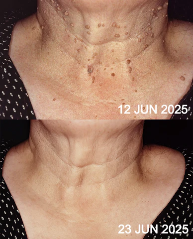 case1_32c65ec6-7d07-45cf-b75d-1b55deea3032_480x480.png?v=1751604330