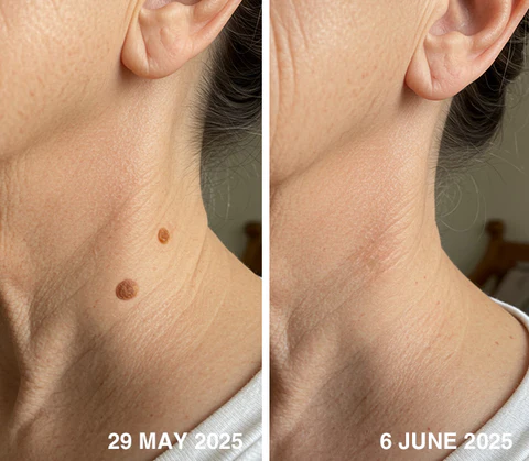 LASERPEN8_480x480.jpg?v=1751621312