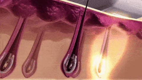 ezgif-com-optimize-2023-07-10-T181118-423