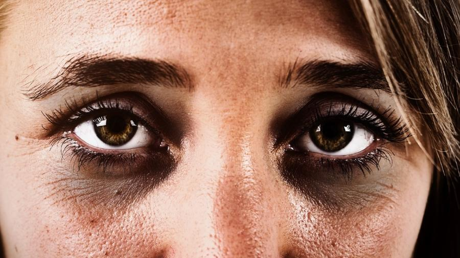 Sol, rinite, colesterol: conheça 10 causas de inchaço nos olhos e olheiras - 23/01/2023 - UOL VivaBem