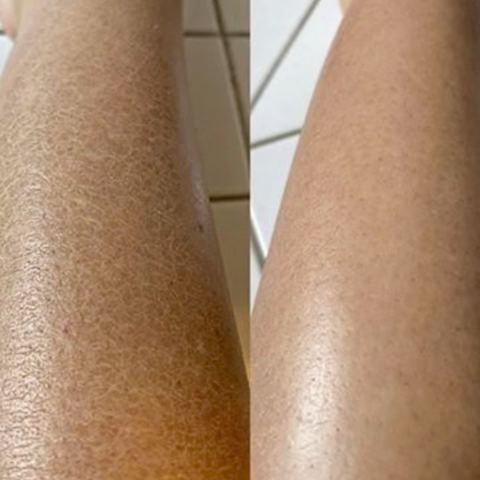 Luva Esfoliante para o Corpo - SkinCare®