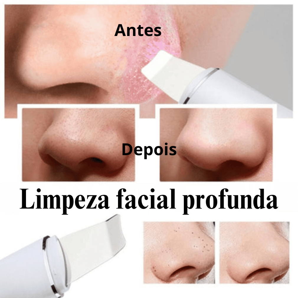 Tecnología de Iones