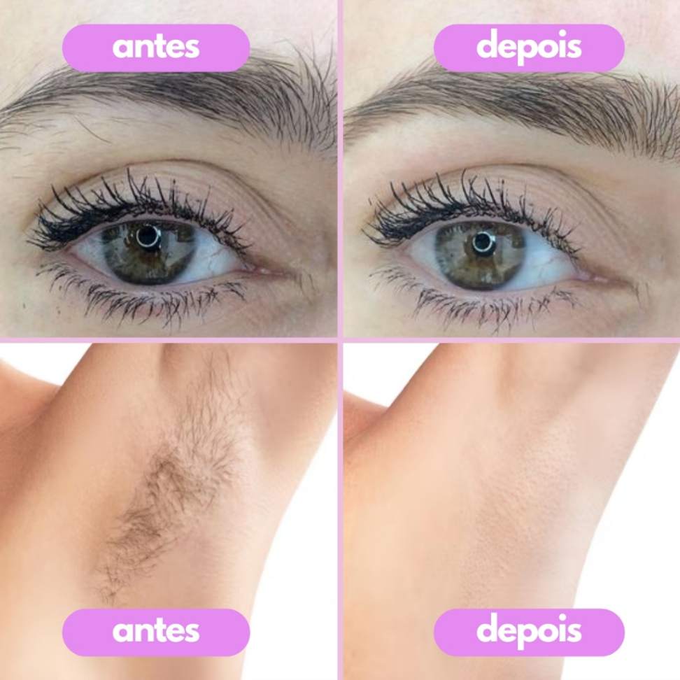 Batom Depilador Facial Elétrico Recarregável Tira Pêlos Buço Sobrancelha BIVOLT - Envio Imediato